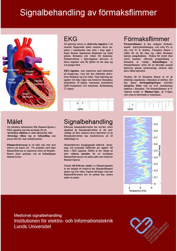 Signalbehandling av förmaksflimmer (pdf 336 kB, ny flik).
