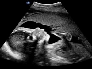 Picture: Ultrasound
