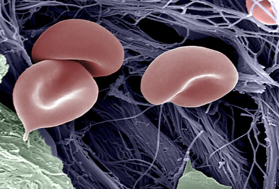 Röda blodkroppar. Bild: Sten Sturefelt.