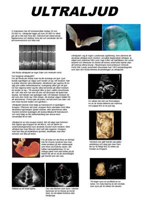 Ultrasound - Poster (pdf 828, new tab, in Swedish).