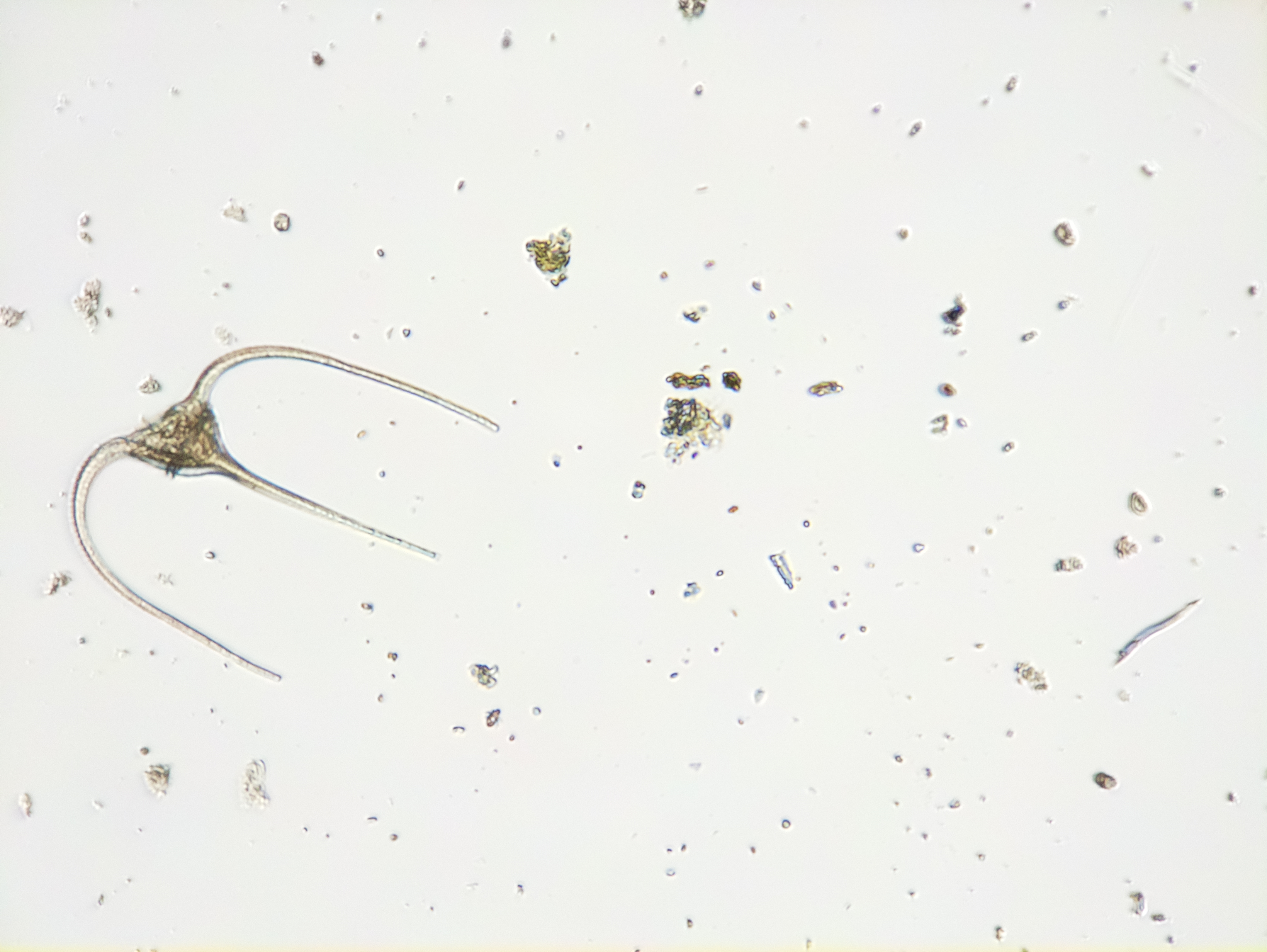 Mikroskopbild på en Dinoflagellat. Foto.