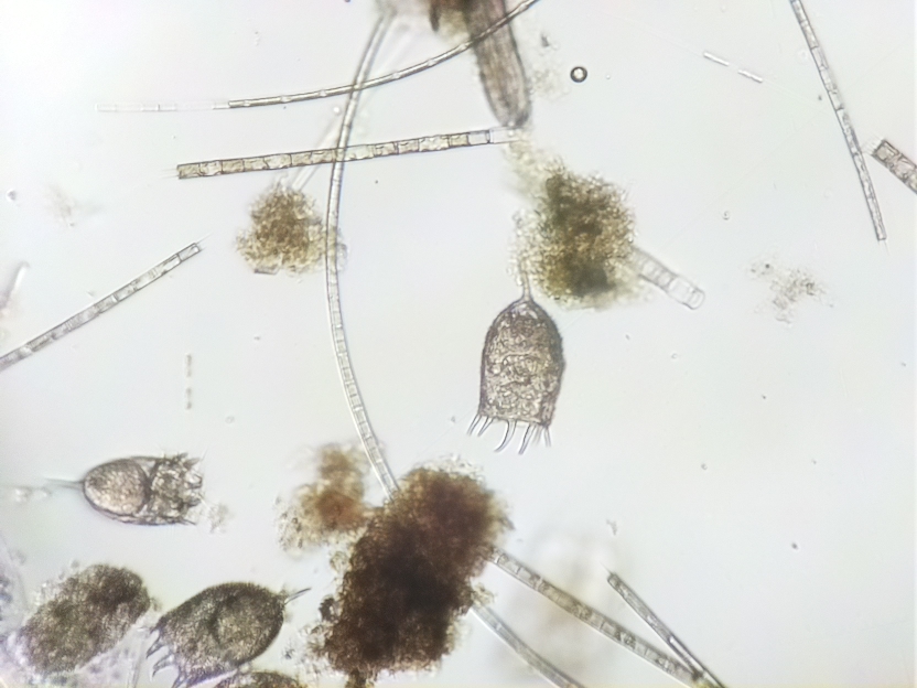 Mikroskopbild på flera hjuldjur. Foto.